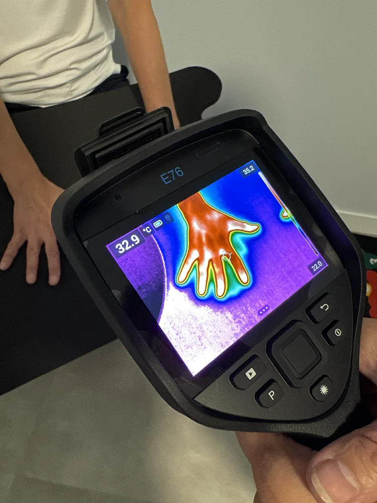 Termogram — badanie diagnostyczne