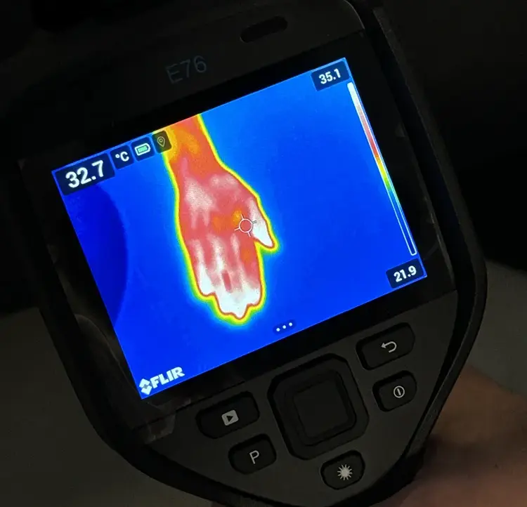 Kamera FLIR E76 pokazująca termogram szyi — kolorowy rozkład temperatur