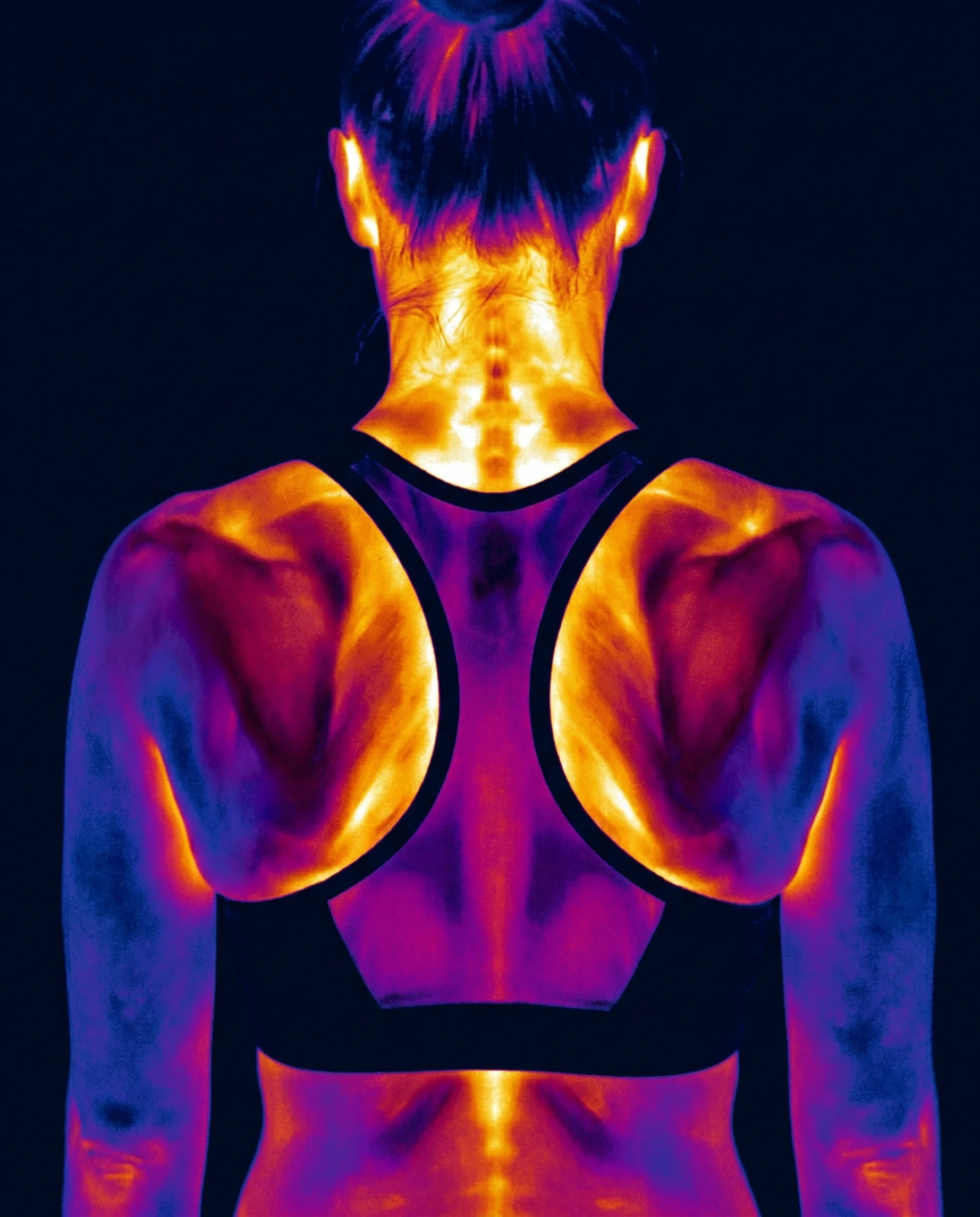 Obraz termograficzny kobiety — widoczne zróżnicowanie temperatur w obrębie karku i barków